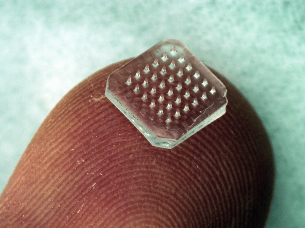 Micron-sized gears produced by microforming and microscale 3D printing